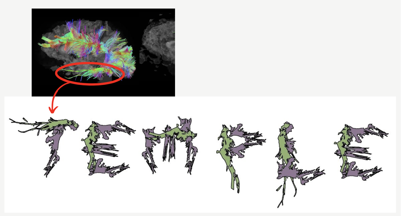 Brain Scan Typography